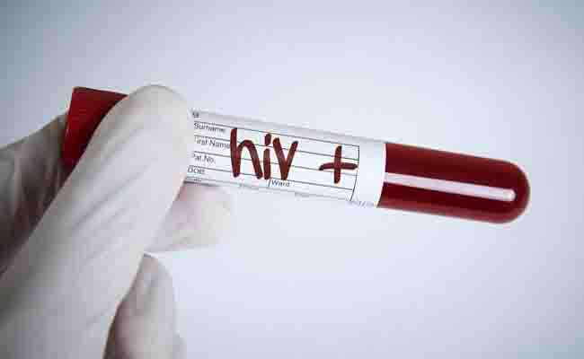 उत्तर प्रदेश : उन्नाव में 40 लोग पाए गए एचआईवी संक्रमित