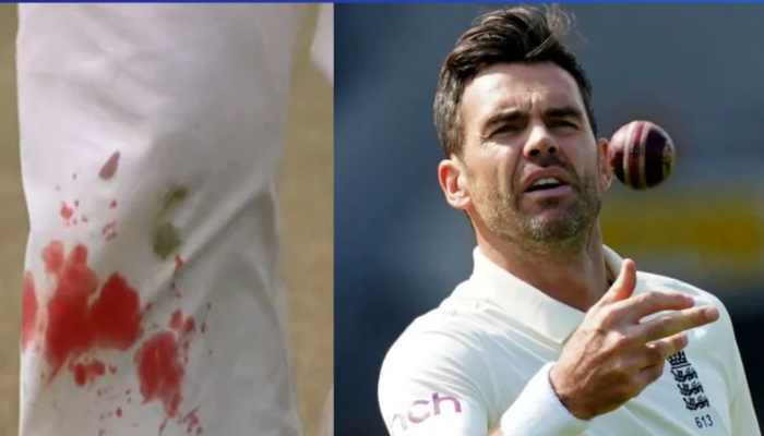 IND vs ENG: घुटने से खून निकलने के बाद भी गेंदबाजी कर रहे थे जेम्स एंडरसन, लोगों ने भी कह दी फिर ये बात